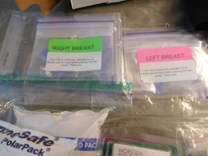 Milk donation helps breast cancer biomarker research project